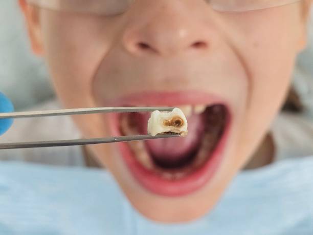 Best Weekend Emergency Dentist in Parkwood, CA
