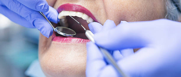 Best Emergency Tooth Extraction in Parkwood, CA